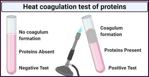heat and acetic acid test|Proteinuria .